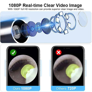 Ear Cleaner Ear Wax Removal With Camera Otoscope 1080P Wirel.