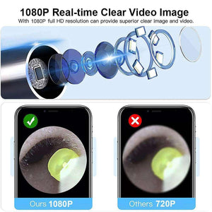 Ear Cleaner Ear Wax Removal With Camera Otoscope 1080P Wirel.