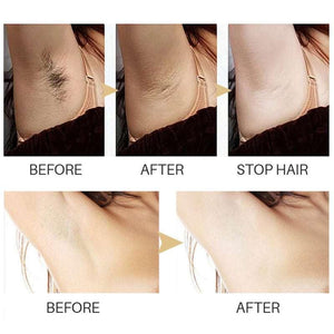 Permanent quick hair removal serum for face and body with natural hair inhibition and smooth skin benefits