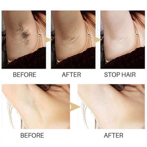Permanent quick hair removal serum for face and body with natural hair inhibition and smooth skin benefits
