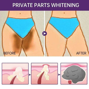 Butt Body Acne Whitening Cream Acne Clearing Spot Treatment