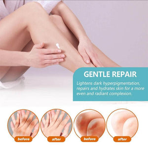 Underarm Whitening Creams For Dark Skin Lightening Body Crot.