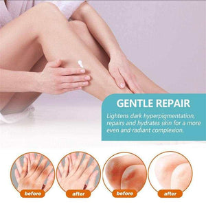 Underarm Whitening Creams For Dark Skin Lightening Body Crot.