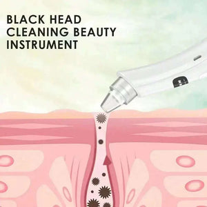 3 Suction Mode Face Cleansing Beauty Machine Dead Skin Remov