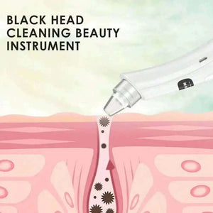 3 Suction Mode Face Cleansing Beauty Machine Dead Skin Remov
