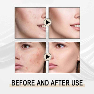 Lactobionic Acid Serum Shrink Pores Moisturizing Essence Liq