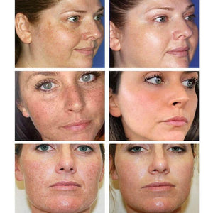 30ML Glutathione Whitening Freckles Serum Remove Dark Spots.