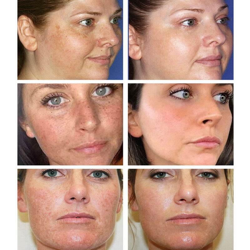 30ML Glutathione Whitening Freckles Serum Remove Dark Spots.