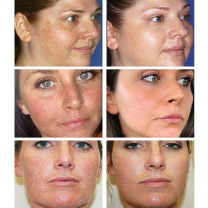 30ML Glutathione Whitening Freckles Serum Remove Dark Spots.
