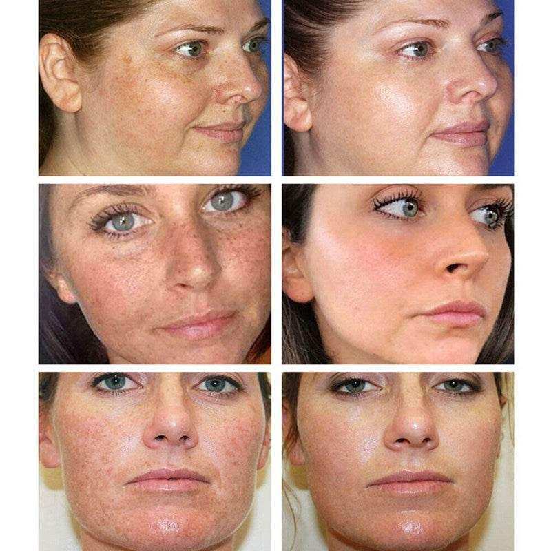 30ML Glutathione Whitening Freckles Serum Remove Dark Spots.