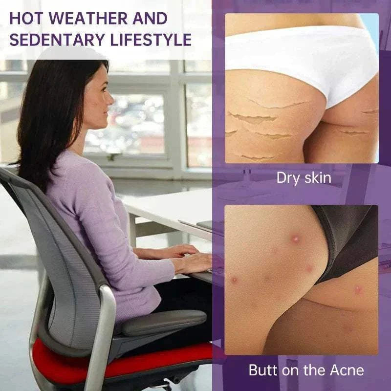 Butt Body Acne Whitening Cream Acne Clearing Spot Treatment
