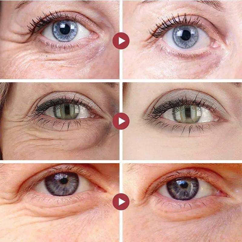 Overnight Eye Lift & Revitalize: 360° hydrogel under eye recovery patch.