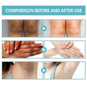 Underarm Whitening Creams For Dark Skin Lightening Body Crot.