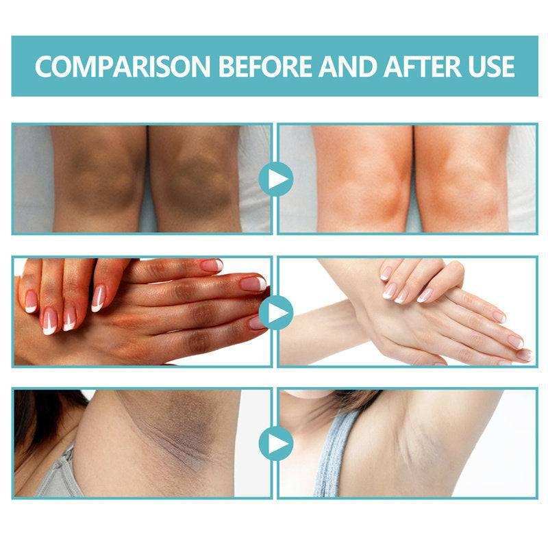 Underarm Whitening Creams For Dark Skin Lightening Body Crot.