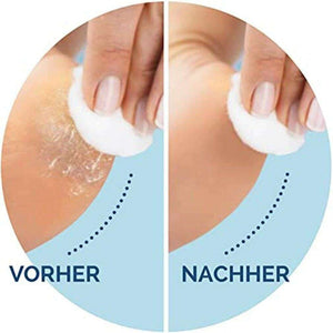 Foot Care Tool Electric Foot File Foot Callouses Dead Skin R.