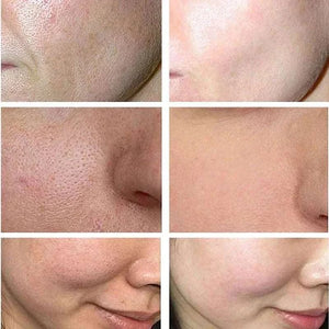 Lactobionic Acid Serum Shrink Pores Moisturizing Essence Liq