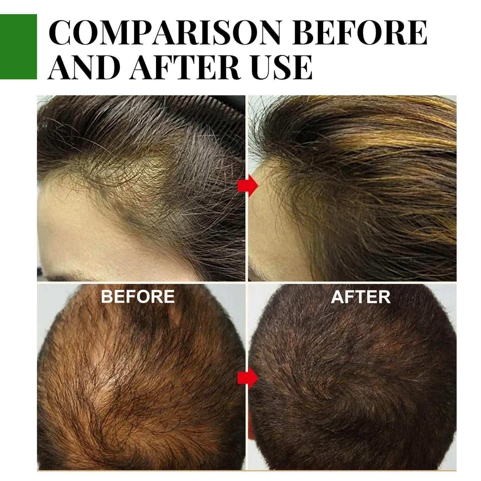 Rosemary Essential Oil Hair Growth Oils Pure Natural 30ML Ha.