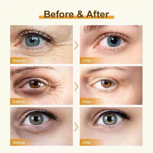 Eye Bags Eye Cream Roller Ball Massager Under Eye Fine Lines