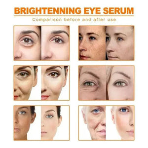 Turmeric Remove Dark Spots Essential Oil Anti wrinkle Serum