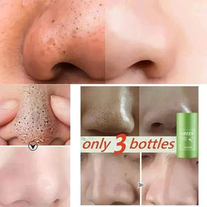Blackhead Remover Face Mask for deep pore cleansing and blackhead removal