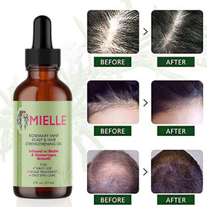 Mielle Rosemary Mint Scalp & Hair Growth Essential Oil – Infused with Biotin & Essential Oils | Nourishing Treatment for Hair Growth, Split Ends & Dry Scalp | 2 fl. oz.