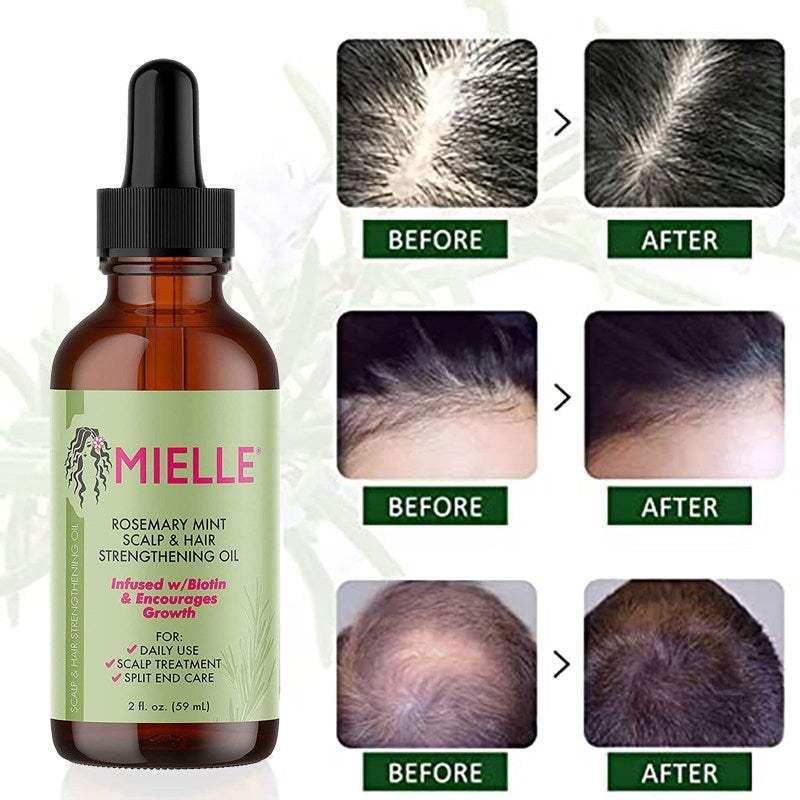 Mielle Rosemary Mint Scalp & Hair Growth Essential Oil – Infused with Biotin & Essential Oils | Nourishing Treatment for Hair Growth, Split Ends & Dry Scalp | 2 fl. oz.