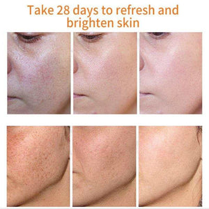 30ML Glutathione Whitening Freckles Serum Remove Dark Spots.