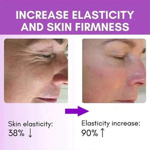 Serum Infused Microneedle Eye Patches Mask For Anti Wrinkle