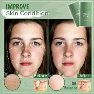 Blackhead remover face mask cream for deep pore cleansing and blackhead removal
