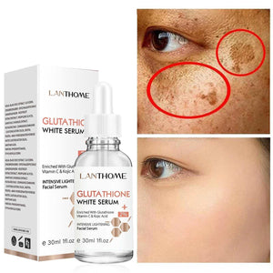 30ML Glutathione Whitening Serum bottle for dark spot and freckles removal