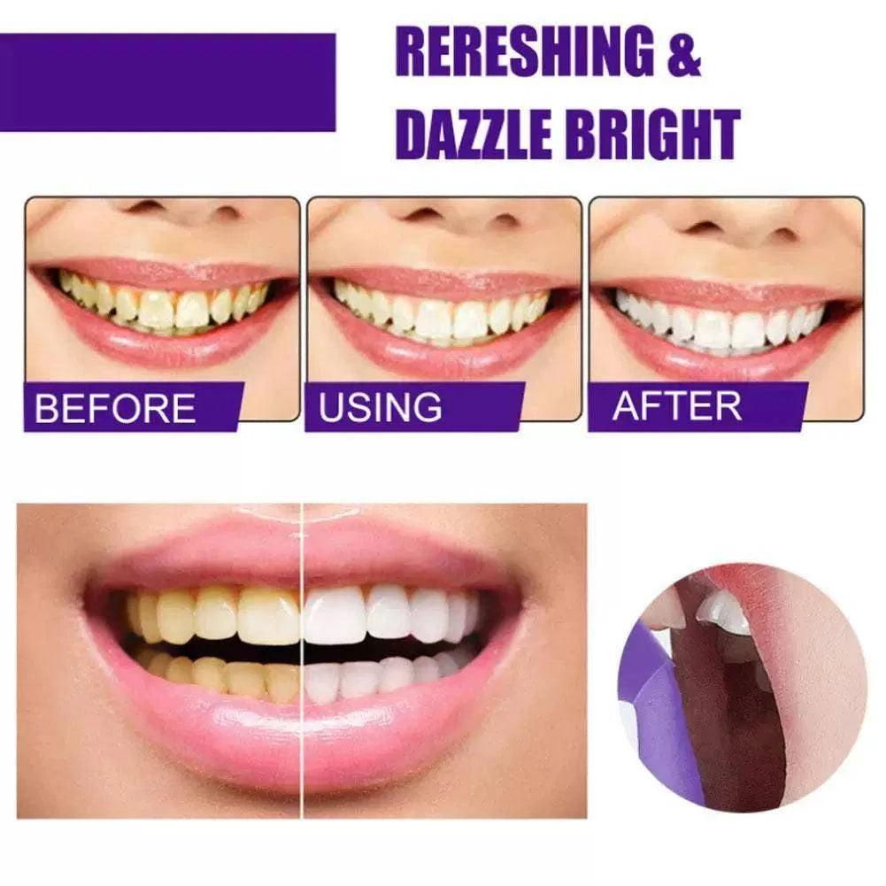 V34 Teeth Cleansing Whitening Mousse Removes Sta Whitening H