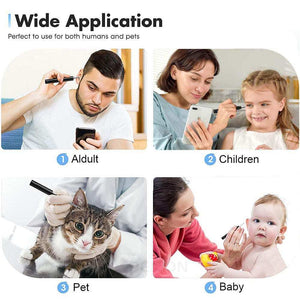 Ear Cleaner Ear Wax Removal With Camera Otoscope 1080P Wirel.