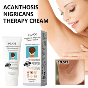 EELHOE underarm whitening cream for dark skin with advanced spot lightening and deep repair