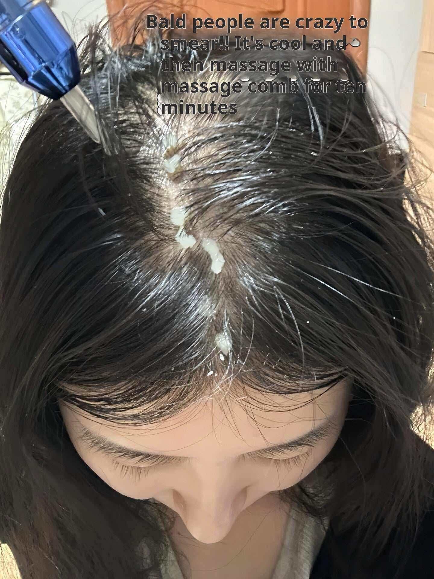 Vivelab Hair Serum|سيروم فايف لاب المتقدم لإنبات الشعر وتكثيف الفراغات