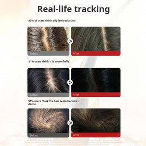 Japan koshitsu ozone scalp red light generator current comb microcurrent care device massage comb