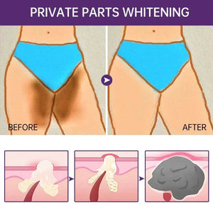 Butt Body Acne Whitening Cream Acne Clearing Spot Treatment