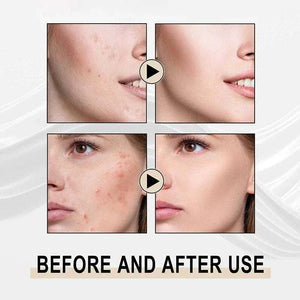 Lactobionic Acid Serum Shrink Pores Moisturizing Essence Liq