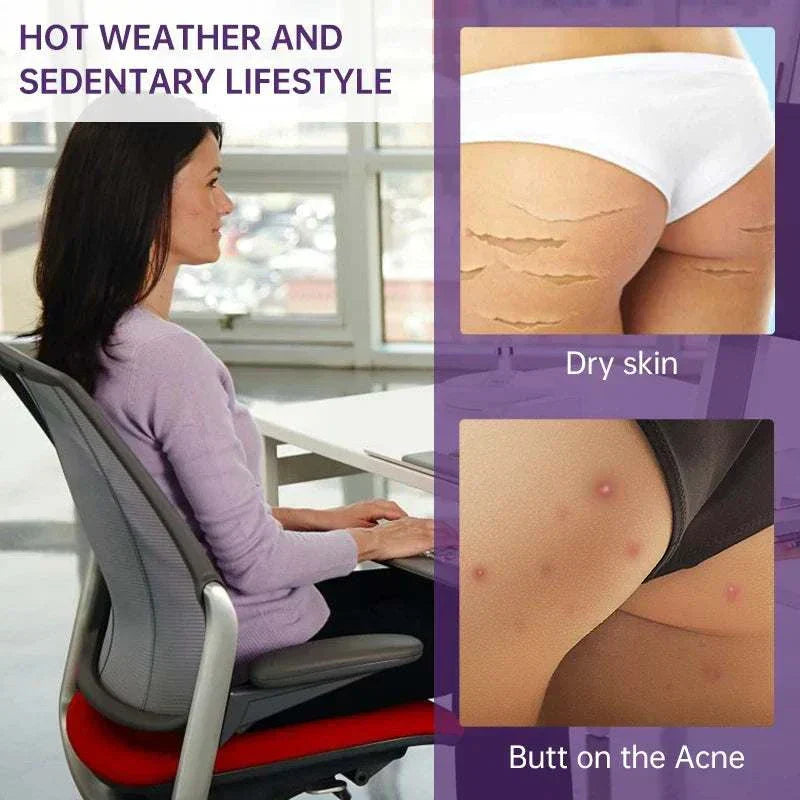 Butt Body Acne Whitening Cream Acne Clearing Spot Treatment