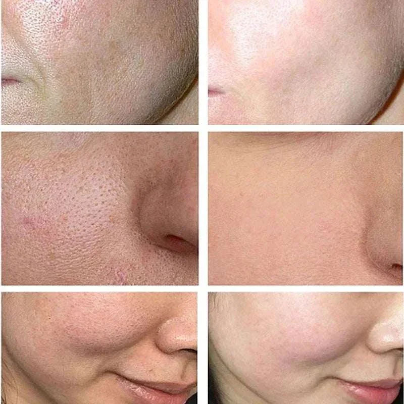 Lactobionic Acid Serum Shrink Pores Moisturizing Essence Liq