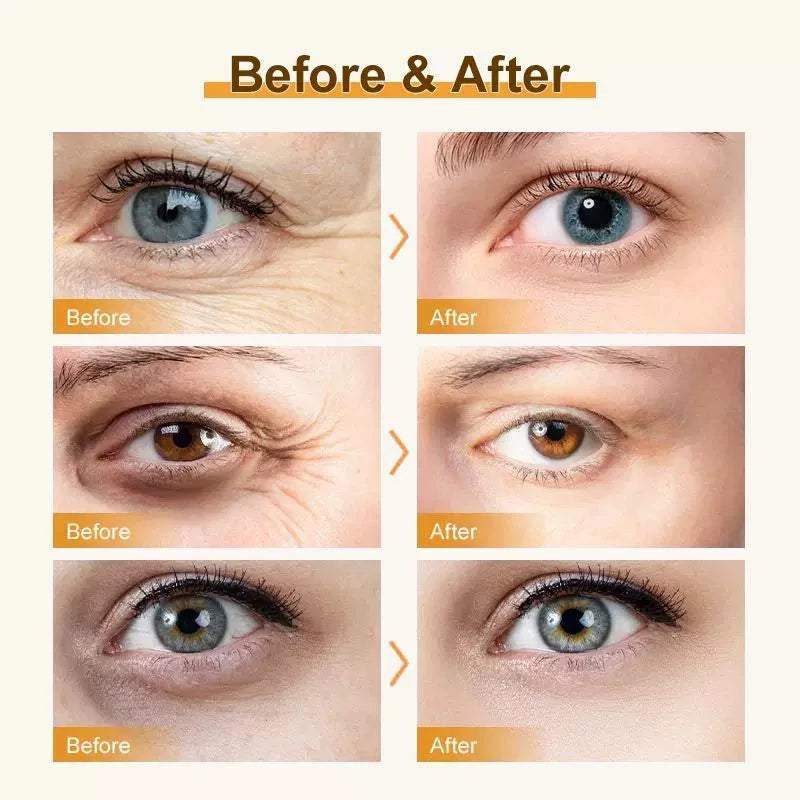 Eye Bags Eye Cream Roller Ball Massager Under Eye Fine Lines