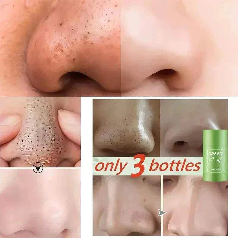 Blackhead Remover Face Mask for deep pore cleansing and blackhead removal