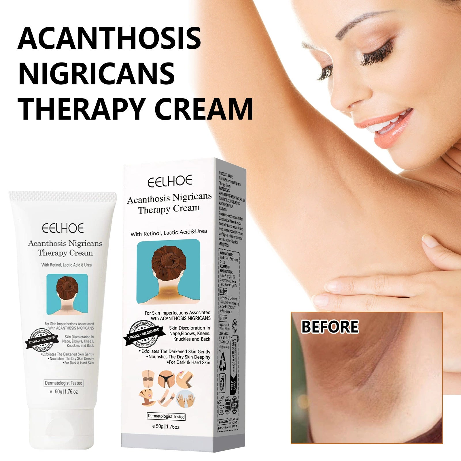 Underarm Whitening Creams For Dark Skin Lightening Body Crot