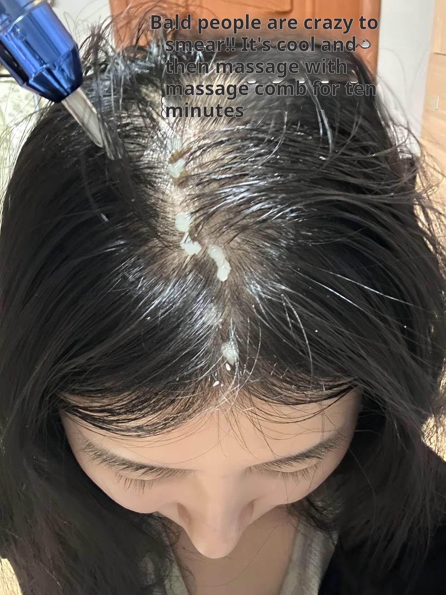 Vivelab Hair Serum|سيروم فايف لاب المتقدم لإنبات الشعر وتكثيف الفراغات