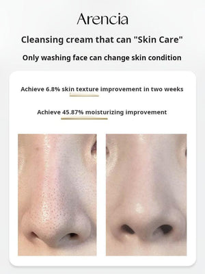 Arencia Green Rice Cake Cleansing Balm, Plant Extract, Deep Moisturizing, Cleansing, Moisturizing, Gentle Skincare Cleanser.